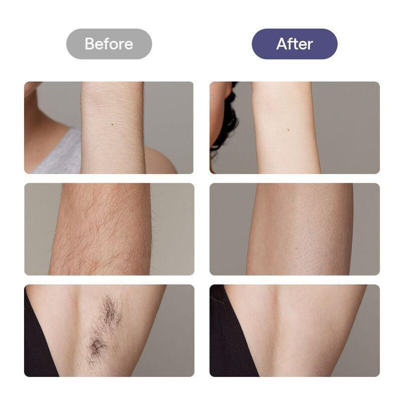 Ulike Air 10 Laser Hair Removal - Purple, , large image number 6