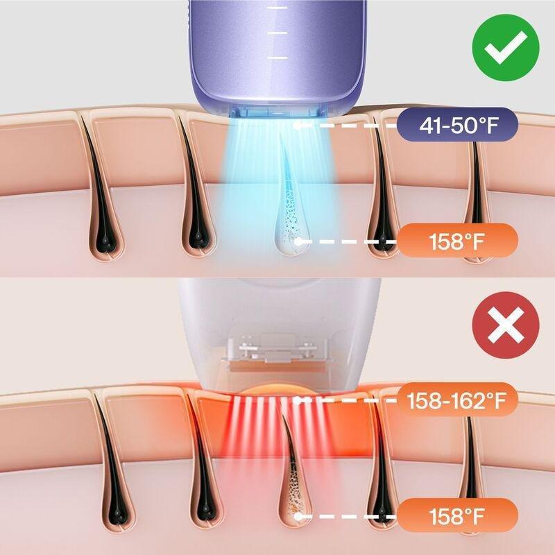 Ulike Air 3 Laser Hair Removal For Women And Men - Purple, , medium