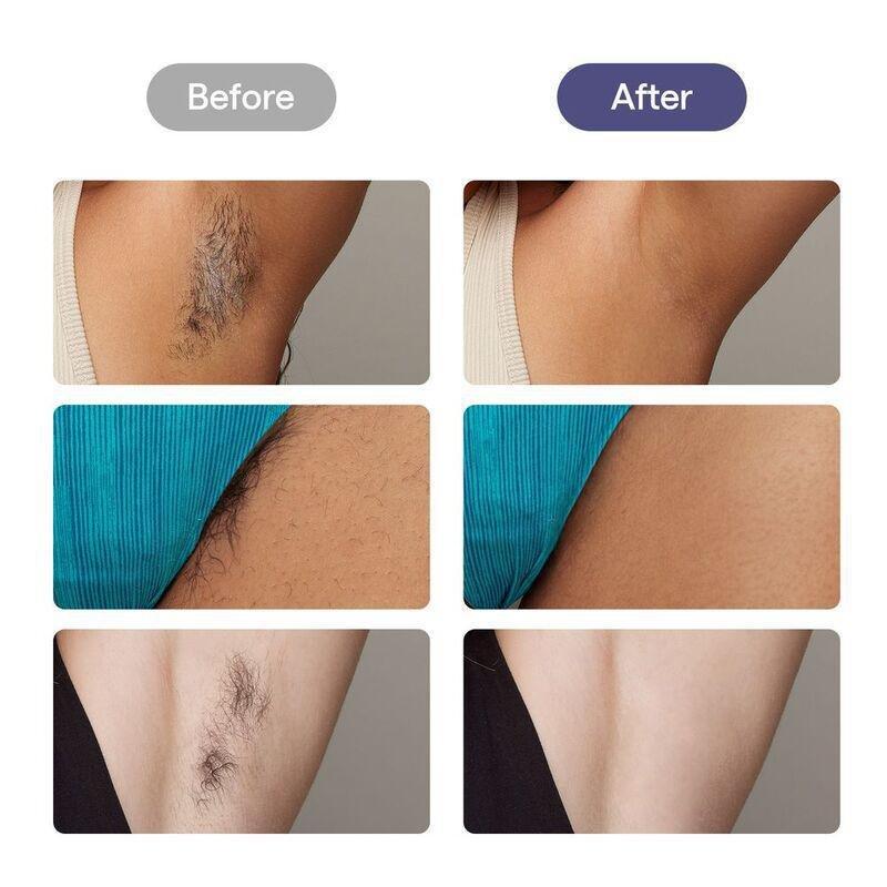 Ulike Air 3 Laser Hair Removal For Women And Men - Purple, , large image number 6
