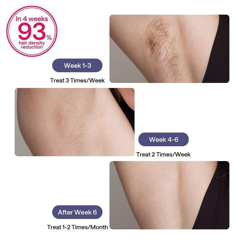 Ulike Laser Hair Removal For Women And Men With Leather Case - Purple, , large image number 6