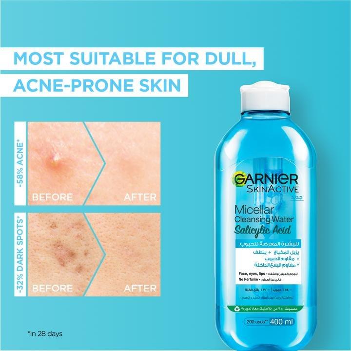 Garnier Fast Clear Salicylic Acid Micellar Water Facial Anti-Acne Cleanser And Makeup Remover, 000, large image number 2